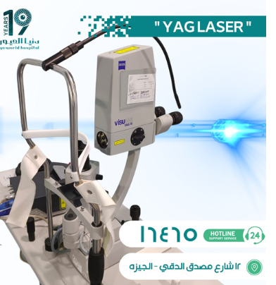 YAG laser